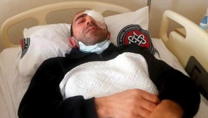 Avcılar Belediyesi çalışanına saldırı: Gözünde yüzde 90 görme kaybı oluştu